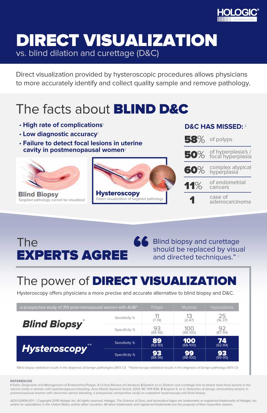Hologic MyoSure Direct Visualization Infographic